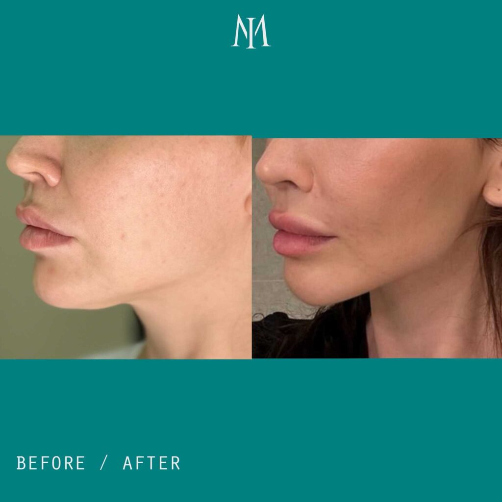 the best facial plastic surgeons 