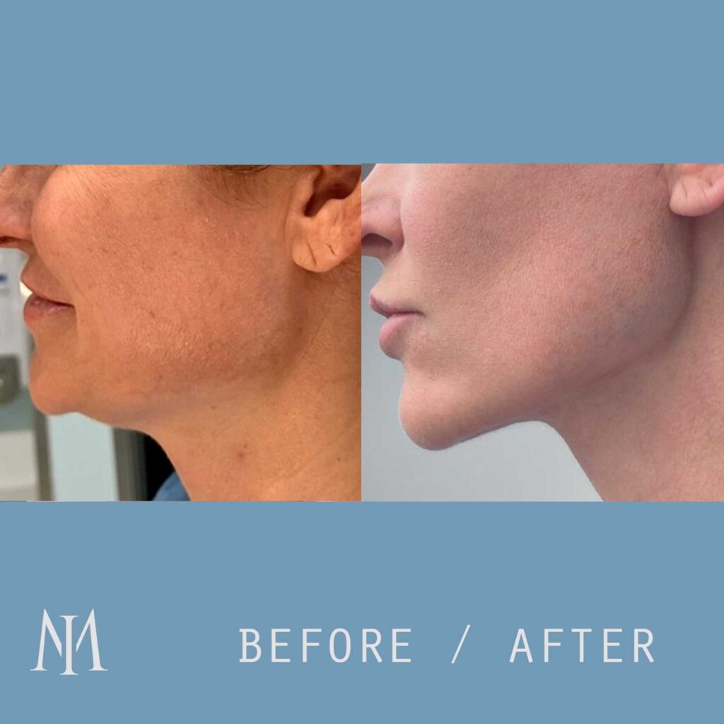 the best facial plastic surgeons 